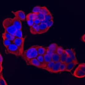 R&D Systems Human NM23-H2 Affinity Purif