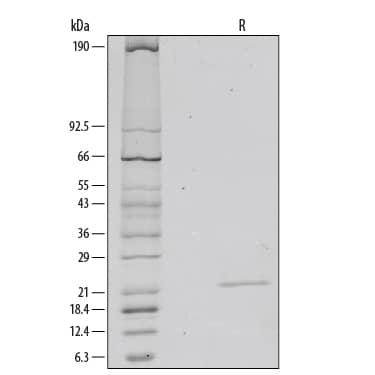 R&D Systems Recombinant Human Sonic Hedg